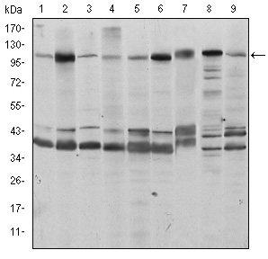 FKTN / Fukutin Antibody - Western blot using FUK mouse monoclonal antibody against HeLa (1), HepG2 (2), Jurkat (3), A431 (4), HEK293 (5), MCF-7 (6), PC-12 (7), Cos7 (8), and NIH/3T3 (9) cell lysate.