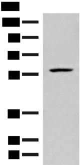 FKTN / Fukutin Antibody - Western blot analysis of Mouse liver tissue lysate  using FKTN Polyclonal Antibody at dilution of 1:450