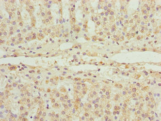 FLAD1 / FADS Antibody - Immunohistochemistry of paraffin-embedded human adrenal gland tissue using FLAD1 Antibody at dilution of 1:100
