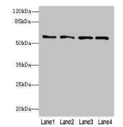 FLAD1 / FADS Antibody - Western blot All lanes: FLAD1 antibody at 4µg/ml Lane 1: K562 whole cell lysate Lane 2: HepG2 whole cell lysate Lane 3: MDA-MB-231 whole cell lysate Lane 4: Hela whole cell lysate Secondary Goat polyclonal to rabbit IgG at 1/10000 dilution Predicted band size: 66, 55, 50, 33, 37 kDa Observed band size: 66 kDa