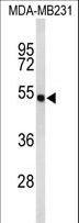FLAD1 / FADS Antibody - Western blot of FLAD1 Antibody in MDA-MB231 cell line lysates (35 ug/lane). FLAD1 (arrow) was detected using the purified antibody.