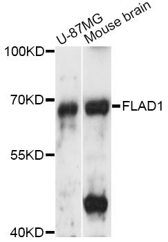 FLAD1 / FADS Antibody - Western blot analysis of extracts of various cell lines, using FLAD1 antibody at 1:3000 dilution. The secondary antibody used was an HRP Goat Anti-Rabbit IgG (H+L) at 1:10000 dilution. Lysates were loaded 25ug per lane and 3% nonfat dry milk in TBST was used for blocking. An ECL Kit was used for detection and the exposure time was 5s.