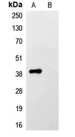 Flag Tag Antibody - Western blot analysis of Anti-FLAG-tag Antibody against HEK293T cells transfected with vector overexpressing FLAG tag (A) and untransfected (B).