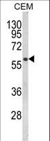 FLCN / Folliculin Antibody - Western blot of FLCN Antibody in CEM cell line lysates (35 ug/lane). FLCN (arrow) was detected using the purified antibody.