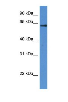 FLCN / Folliculin Antibody - FLCN / Folliculin antibody Western blot of Fetal Heart lysate. Antibody concentration 1 ug/ml.  This image was taken for the unconjugated form of this product. Other forms have not been tested.