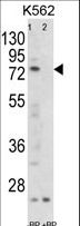 FLCN / Folliculin Antibody - Western blot of FLCN Antibody antibody pre-incubated without(lane 1) and with(lane 2) blocking peptide in K562 cell line lysate. FLCN (arrow) was detected using the purified antibody.