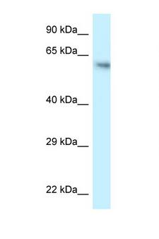 FLCN / Folliculin Antibody - FLCN / Folliculin antibody Western blot of HCT15 Cell lysate. Antibody concentration 1 ug/ml.  This image was taken for the unconjugated form of this product. Other forms have not been tested.