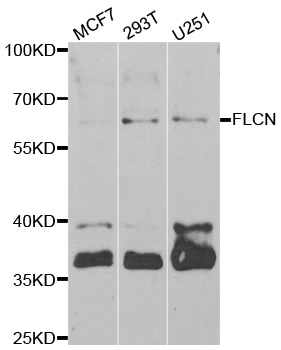 FLCN / Folliculin Antibody - Western blot analysis of extracts of various cell lines.