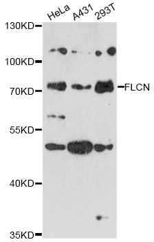 FLCN / Folliculin Antibody - Western blot analysis of extracts of various cell lines, using FLCN antibody at 1:3000 dilution. The secondary antibody used was an HRP Goat Anti-Rabbit IgG (H+L) at 1:10000 dilution. Lysates were loaded 25ug per lane and 3% nonfat dry milk in TBST was used for blocking. An ECL Kit was used for detection and the exposure time was 10s.