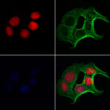 FLCN / Folliculin Antibody - Staining HeLa cells by IF/ICC. The samples were fixed with PFA and permeabilized in 0.1% Triton X-100, then blocked in 10% serum for 45 min at 25°C. Samples were then incubated with primary Ab(1:200) and mouse anti-beta tubulin Ab(1:200) for 1 hour at 37°C. An AlexaFluor594 conjugated goat anti-rabbit IgG(H+L) Ab(1:200 Red) and an AlexaFluor488 conjugated goat anti-mouse IgG(H+L) Ab(1:600 Green) were used as the secondary antibod