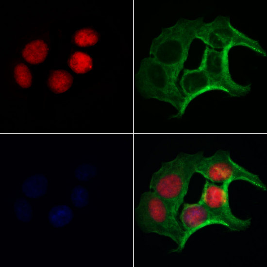 FLCN / Folliculin Antibody - Staining HeLa cells by IF/ICC. The samples were fixed with PFA and permeabilized in 0.1% Triton X-100, then blocked in 10% serum for 45 min at 25°C. Samples were then incubated with primary Ab(1:200) and mouse anti-beta tubulin Ab(1:200) for 1 hour at 37°C. An AlexaFluor594 conjugated goat anti-rabbit IgG(H+L) Ab(1:200 Red) and an AlexaFluor488 conjugated goat anti-mouse IgG(H+L) Ab(1:600 Green) were used as the secondary antibod