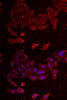 FLCN / Folliculin Antibody - Immunofluorescence analysis of A549 cells using FLCN Polyclonal Antibody.