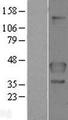 FLCN / Folliculin Protein - Western validation with an anti-DDK antibody * L: Control HEK293 lysate R: Over-expression lysate