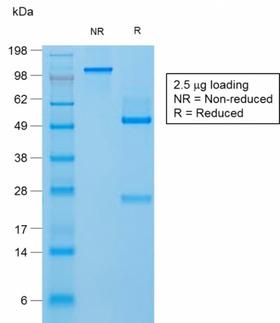FLG / Filaggrin Antibody - SDS-PAGE Analysis Purified Filaggrin Rabbit Recombinant Monoclonal Antibody (FLG/1957R). Confirmation of Purity and Integrity of Antibody.