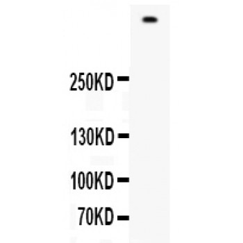 FLG / Filaggrin Antibody - Western blot analysis of Filaggrin expression in 22RV1 whole cell lysates (lane 1). Filaggrin at 435 kD was detected using rabbit anti- Filaggrin Antigen Affinity purified polyclonal antibody at 0.5 ug/mL. The blot was developed using chemiluminescence (ECL) method.