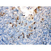 FLG / Filaggrin Antibody - Filaggrin was detected in paraffin-embedded sections of human Tonsil tissues using rabbit anti- Filaggrin Antigen Affinity purified polyclonal antibody at 1 ug/mL. The immunohistochemical section was developed using SABC method.