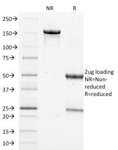 FLG / Filaggrin Antibody - SDS-PAGE Analysis of Purified, BSA-Free Filaggrin Antibody (clone FLG/1562). Confirmation of Integrity and Purity of the Antibody.