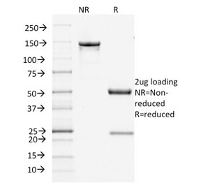 FLG / Filaggrin Antibody - SDS-PAGE analysis of purified, BSA-free Filaggrin antibody (clone FLG/1945) as confirmation of integrity and purity.