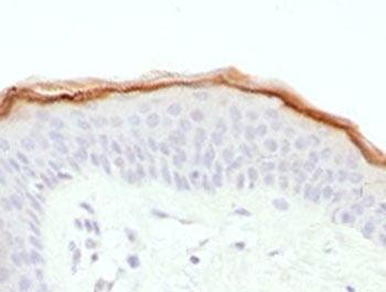 FLG / Filaggrin Antibody - IHC testing of FFPE human skin with Filaggrin antibody (clone FLG1-1). Required HIER: boil tissue sections in 10mM citrate buffer, pH 6, for 10-20 min.