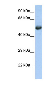 FLI1 Antibody - FLI1 antibody Western blot of Jurkat lysate. This image was taken for the unconjugated form of this product. Other forms have not been tested.