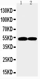 FLI1 Antibody - WB of FLI1 / FLI-1 antibody. Lane 1: JURKAT Cell Lysate. Lane 2: RAJI Cell Lysate.