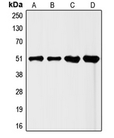 FLI1 Antibody - Western blot analysis of FLI1 expression in HeLa (A); Jurkat (B); mouse liver (C); rat liver (D) whole cell lysates.