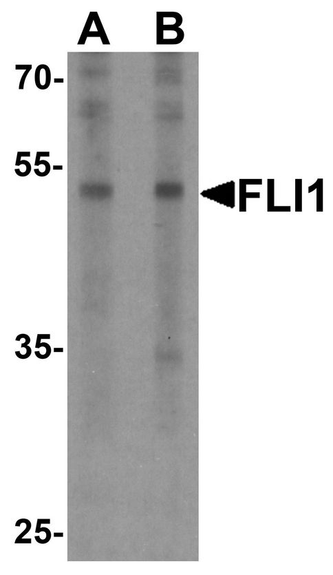 FLI1 Antibody - Western blot analysis of FLI1 in Jurkat cell lysate with FLI1 antibody at (A) 0.5 and (B) 1 ug/ml.
