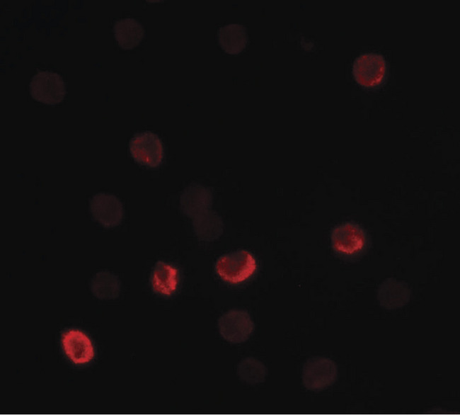 FLI1 Antibody - Immunofluorescence of MUC1 in HeLa cells with MUC1 antibody at 5 ug/ml.
