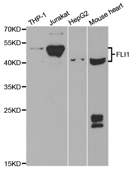 FLI1 Antibody - Western blot analysis of extracts of various cell lines.
