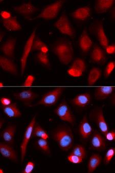 FLI1 Antibody - Immunofluorescence analysis of U2OS cells.