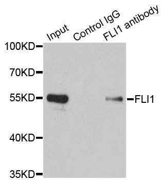 FLI1 Antibody - Immunoprecipitation analysis of 200ug extracts of Jurkat cells.