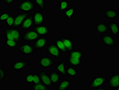 FLI1 Antibody - Immunofluorescent analysis of A549 cells at a dilution of 1:100 and Alexa Fluor 488-congugated AffiniPure Goat Anti-Rabbit IgG(H+L)
