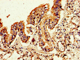 FLI1 Antibody - Immunohistochemistry image of paraffin-embedded human lung tissue at a dilution of 1:100