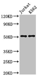 FLI1 Antibody - Positive Western Blot detected in Jurkat whole cell lysate, K562 whole cell lysate. All lanes: FLI1 antibody at 3 µg/ml Secondary Goat polyclonal to rabbit IgG at 1/50000 dilution. Predicted band size: 51, 44 KDa. Observed band size: 51 KDa