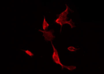 FLI1 Antibody - Staining NIH-3T3 cells by IF/ICC. The samples were fixed with PFA and permeabilized in 0.1% Triton X-100, then blocked in 10% serum for 45 min at 25°C. The primary antibody was diluted at 1:200 and incubated with the sample for 1 hour at 37°C. An Alexa Fluor 594 conjugated goat anti-rabbit IgG (H+L) Ab, diluted at 1/600, was used as the secondary antibody.