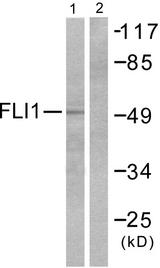 FLI1 Antibody - Western blot analysis of extracts from NIH/3T3 cells, using FLI1 antibody.