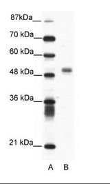 FLI1 Antibody - A: Marker, B: Jurkat Cell Lysate.  This image was taken for the unconjugated form of this product. Other forms have not been tested.