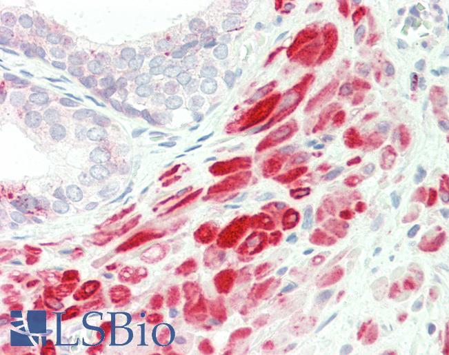 FLII / FLI Antibody - Human, Prostate: Formalin-Fixed Paraffin-Embedded (FFPE).  This image was taken for the unconjugated form of this product. Other forms have not been tested.