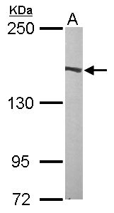 FLII / FLI Antibody - Sample (50 ug of whole cell lysate). A: Mouse brain. 5% SDS PAGE. FLII / FLI antibody diluted at 1:1000.