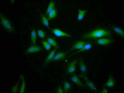 FLII / FLI Antibody - Immunofluorescence staining of Hela cells at a dilution of 1:166, counter-stained with DAPI. The cells were fixed in 4% formaldehyde, permeabilized using 0.2% Triton X-100 and blocked in 10% normal Goat Serum. The cells were then incubated with the antibody overnight at 4 °C.The secondary antibody was Alexa Fluor 488-congugated AffiniPure Goat Anti-Rabbit IgG (H+L) .