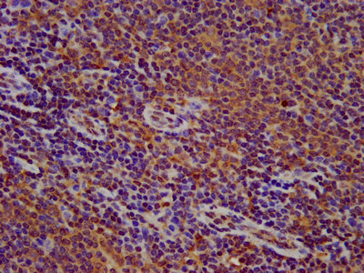 FLII / FLI Antibody - IHC image of FLII Antibody diluted at 1:500 and staining in paraffin-embedded human lymph node tissue performed on a Leica BondTM system. After dewaxing and hydration, antigen retrieval was mediated by high pressure in a citrate buffer (pH 6.0). Section was blocked with 10% normal goat serum 30min at RT. Then primary antibody (1% BSA) was incubated at 4°C overnight. The primary is detected by a biotinylated secondary antibody and visualized using an HRP conjugated SP system.