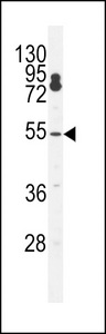 FLJ12529 / CPSF7 Antibody - CPSF7 Antibody western blot of K562 cell line lysates (35 ug/lane). The CPSF7 antibody detected the CPSF7 protein (arrow).