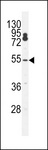 FLJ12529 / CPSF7 Antibody - CPSF7 Antibody western blot of K562 cell line lysates (35 ug/lane). The CPSF7 antibody detected the CPSF7 protein (arrow).