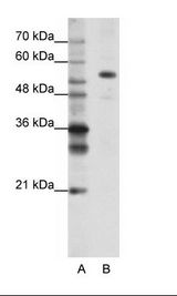 FLJ12529 / CPSF7 Antibody - A: Marker, B: HepG2 Cell Lysate, Conc: 1.25ug/ml.  This image was taken for the unconjugated form of this product. Other forms have not been tested.