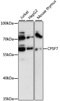 FLJ12529 / CPSF7 Antibody - Western blot analysis of extracts of various cell lines, using CPSF7 antibody at 1:3000 dilution. The secondary antibody used was an HRP Goat Anti-Rabbit IgG (H+L) at 1:10000 dilution. Lysates were loaded 25ug per lane and 3% nonfat dry milk in TBST was used for blocking. An ECL Kit was used for detection and the exposure time was 10s.