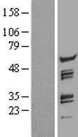 FLJ12529 / CPSF7 Protein - Western validation with an anti-DDK antibody * L: Control HEK293 lysate R: Over-expression lysate