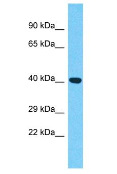 FLJ22028 Antibody - FLJ22028 antibody Western Blot of COLO205. Antibody dilution: 1 ug/ml.  This image was taken for the unconjugated form of this product. Other forms have not been tested.