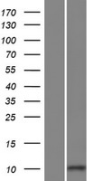 FLJ25363 Protein - Western validation with an anti-DDK antibody * L: Control HEK293 lysate R: Over-expression lysate