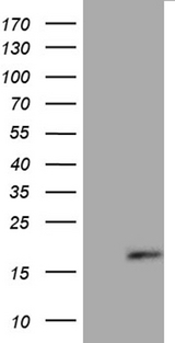 FLJ33360 Antibody - HEK293T cells were transfected with the pCMV6-ENTRY control. (Left lane) or pCMV6-ENTRY FLJ33360. (Right lane) cDNA for 48 hrs and lysed. Equivalent amounts of cell lysates. (5 ug per lane) were separated by SDS-PAGE and immunoblotted with anti-FLJ33360. (1:500)