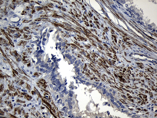 FLJ33360 Antibody - Immunohistochemical staining of paraffin-embedded Human prostate tissue within the normal limits using anti-FLJ33360 mouse monoclonal antibody. (Heat-induced epitope retrieval by 1mM EDTA in 10mM Tris buffer. (pH8.5) at 120°C for 3 min. (1:500)